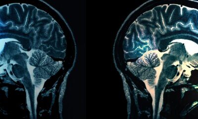 Are teens mentally prepared to drive? A study from NOYS